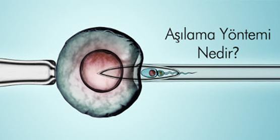 Aşılama yöntemi nedir ?