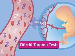 Gebelikte Dörtlü Tarama Testi