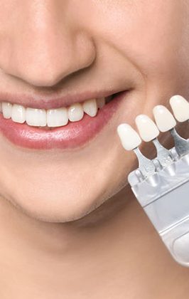 Zahnkronen-und-Porzellan-Kronen