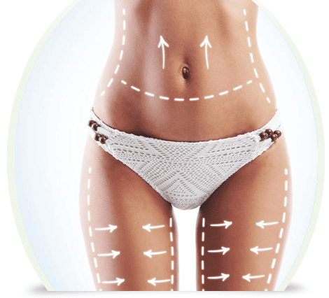 zayıflama-ve-selülit-tedavisi-antalya