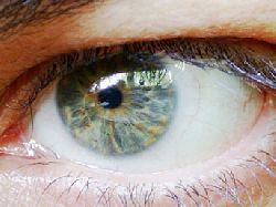 glokom göz tansiyonu