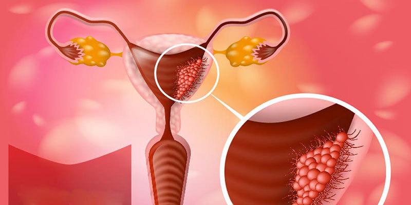 Rahim Ağzı Kanseri, Serviks Kanseri