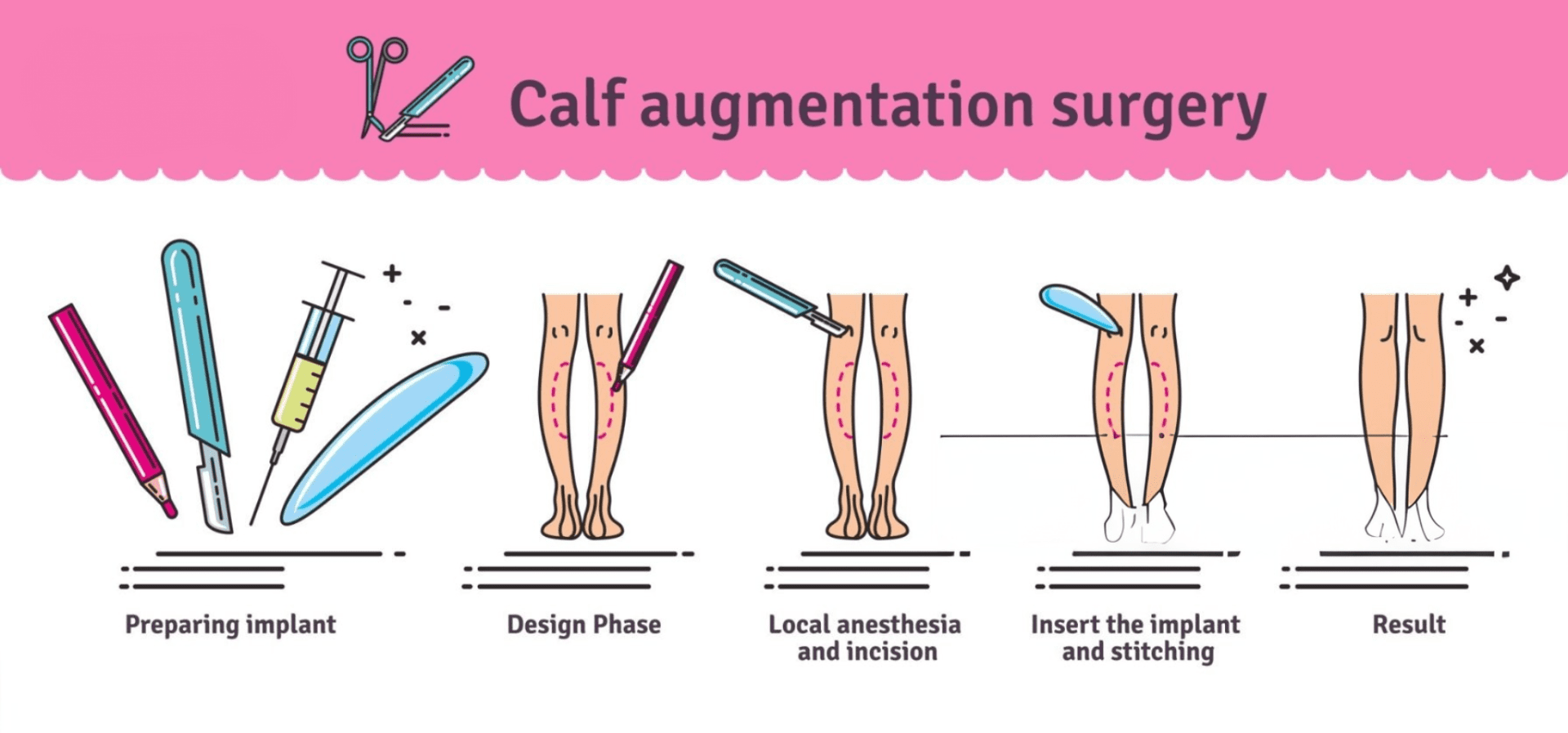 Formedi Calf Implant surgery