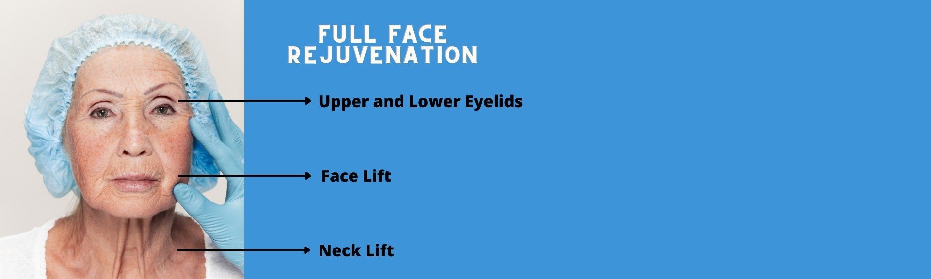 Formedi Full face lift
