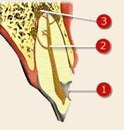 Endodonti