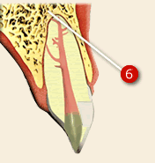 Endodonti 4