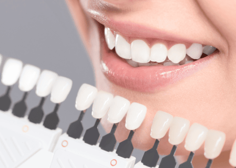 yerli implant fiyatları 2023