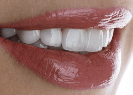 implant nasil takilir