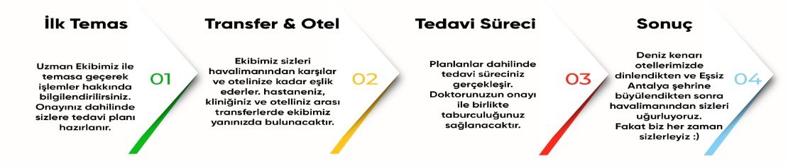 TR - İşlem Süreci - İnfografic