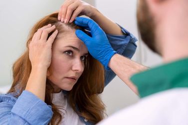 Haartransplantation bei der Frauen