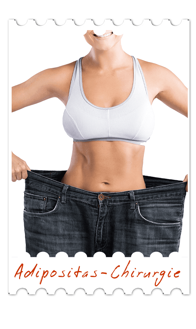 Adipositas-Chirurgie