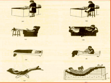 venöz yetmezlikten korunma yolları