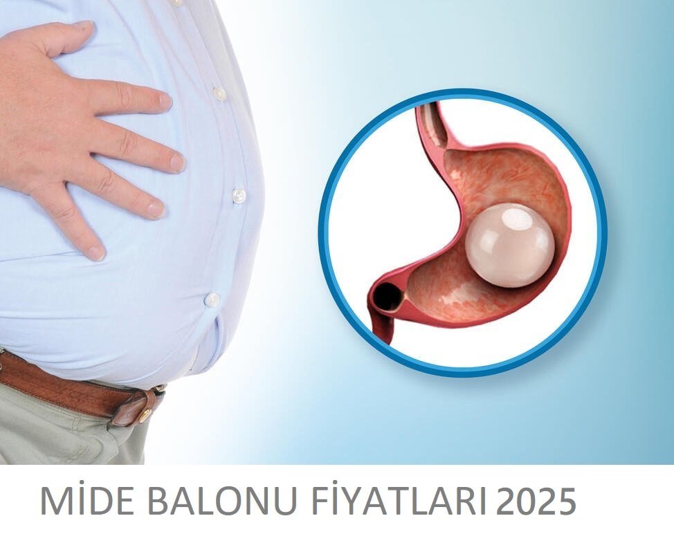mide balonu fiyatlari 2025
