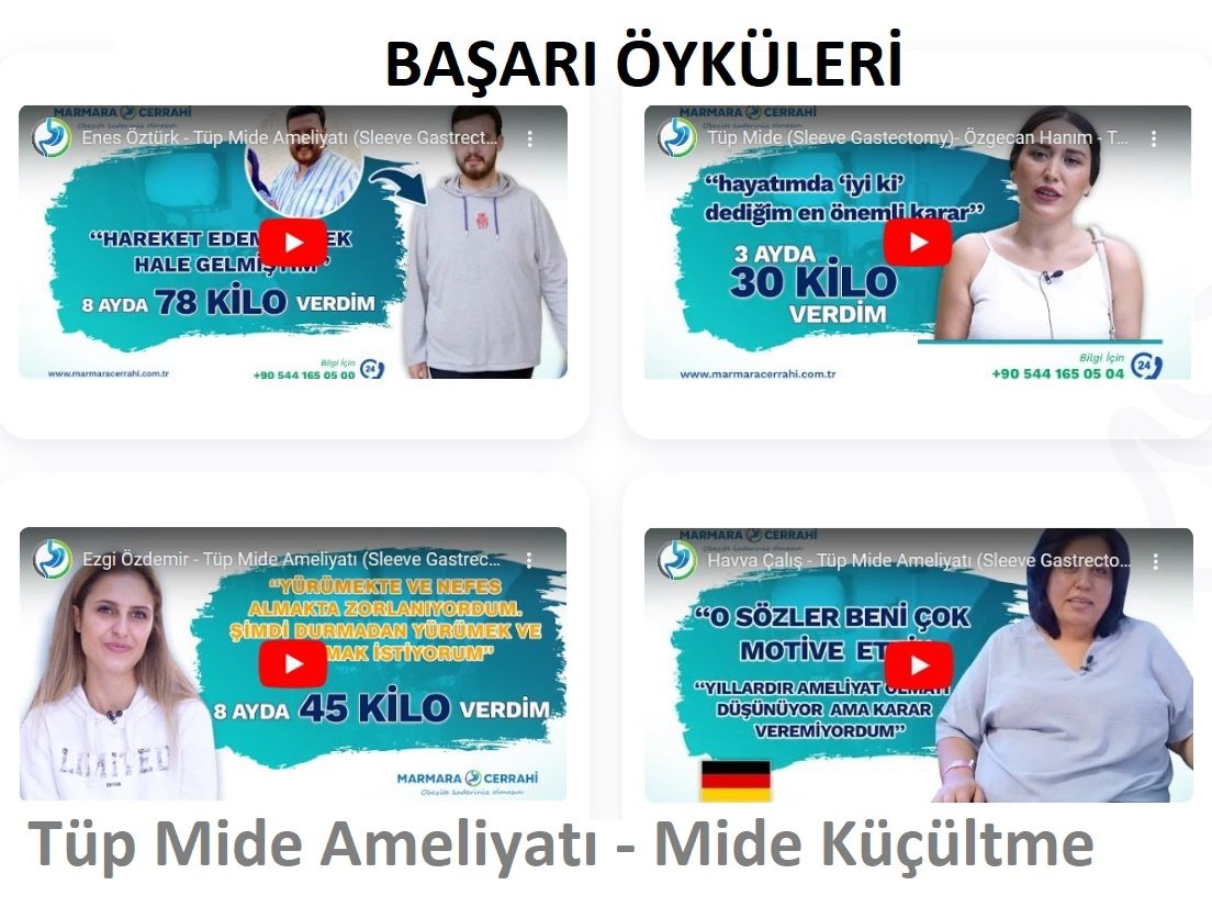 basari_oykuleri_tup_mide_kucultme_ameliyati_nasil_yapi