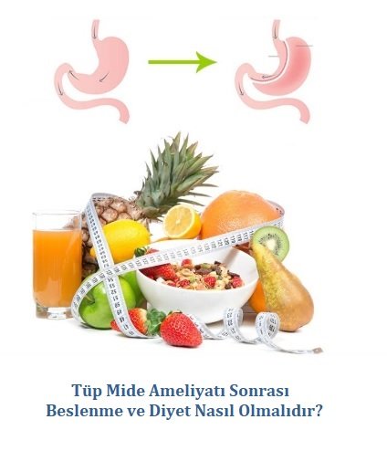 Tüp_Mide_ Ameliyati_Sonrasi_Beslenme_Nasıl_Olmalidir