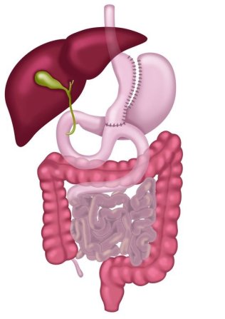 csm_Bariatric_Omega_Loop_Magenbypass_5c8cae2bf0