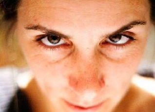 Kırşıklık Tedavisi