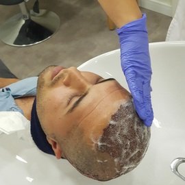 HAARTRANSPLANTATION