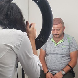 HAARTRANSPLANTATION