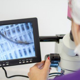 HAARTRANSPLANTATION