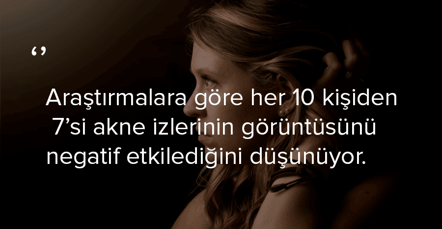 akne_arastirma