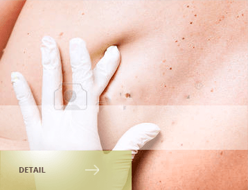 Repair-Surgery