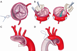 cover_article_11144_en_US