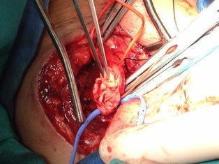 ilhan ı phone son 383