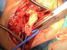 ilhan ı phone son 387