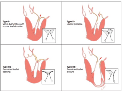 Kaydedilmemiş Önizleme Belgesi