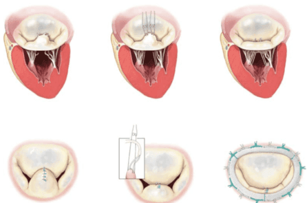Kaydedilmemiş Önizleme Belgesi