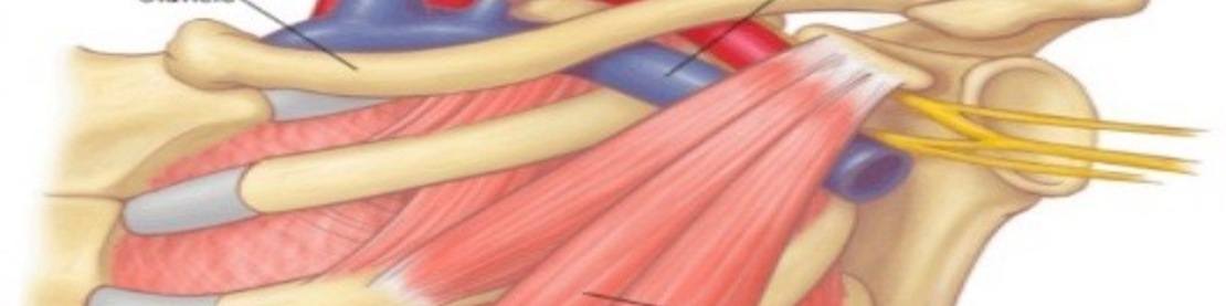 TORASİK ÇIKIŞ SENDROMU