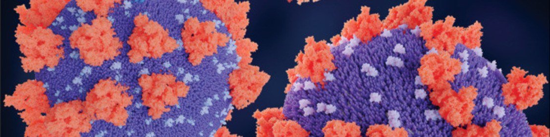 Kalp damar hastalıkları ve covid-19