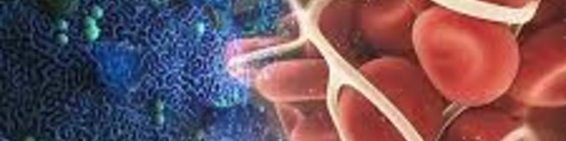 COVID-19'da Trombotik komplikasyonlar