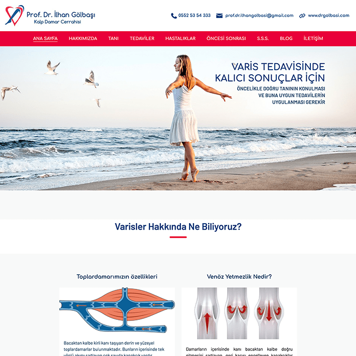 Varis-Tedavisi