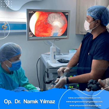 Mide Balonu operasyon zamanı