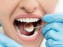 How to treat eroded tooth enamel? - Dentist Funda Özen