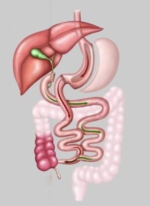 seker-ameliyati-istanbul
