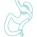 Gastric Bypass in Turkey