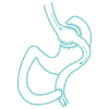 Gastric Bypass Surgery in Turkey