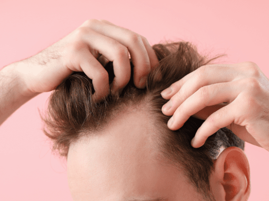 Treating Folliculitis After a Hair Transplant - DK Klinik