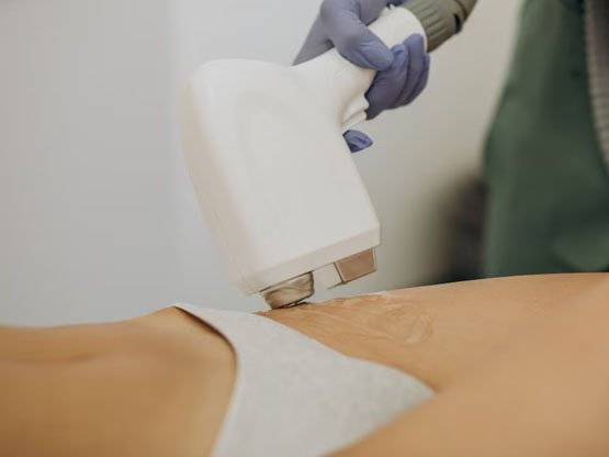 Genital Bölge Lazer Epilasyon Ankara Kızılay