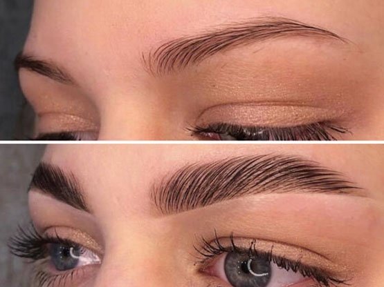 Ankara Kaş Laminasyonu 5