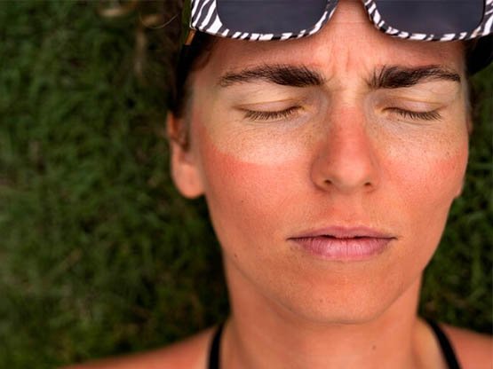 Cilt Lekesi bakımı 2 yan