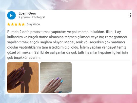 Ecem Hanım'ın Ankara Protez Tırnak Önerisi