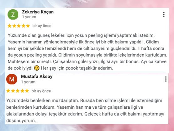 Mustafa Bey'in Ankara Güzellik Merkezi Ben Silme İş