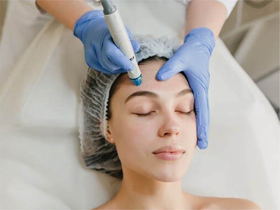 Ankara Hydrafacial Cilt Bakımı 2