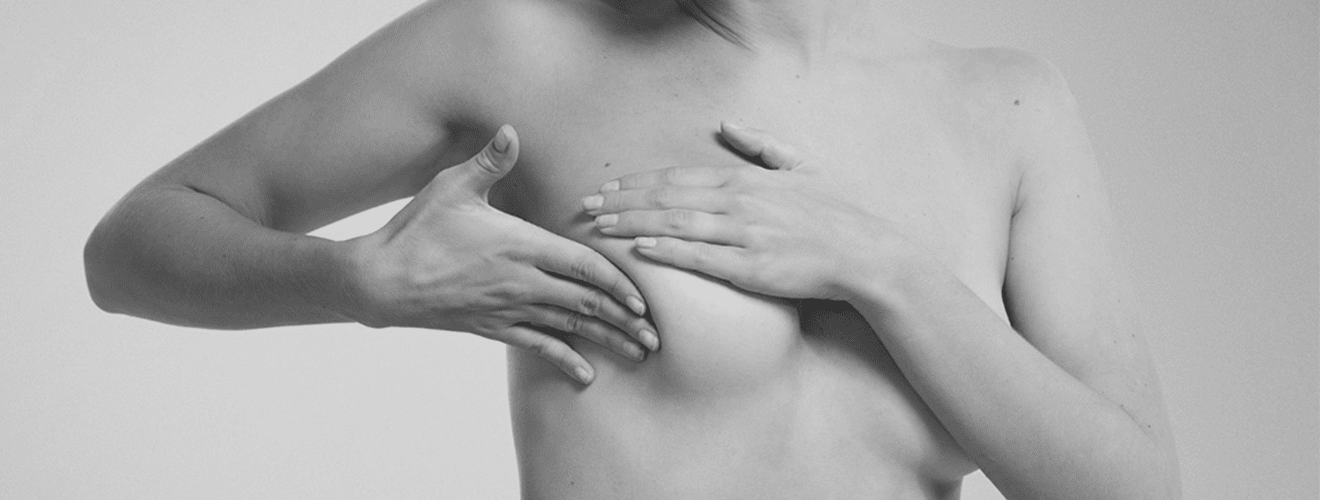Woman indicating the lifted and ideal breast shape targeted with breast lift surgery (mastopexy).
