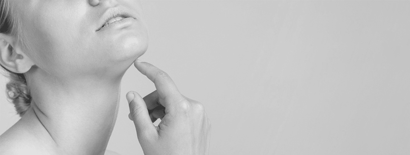 Woman pointing to the submental area under the chin targeted by chin liposuction (double chin removal).