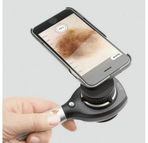 dermatoskop-cihazi-telefon-300x289